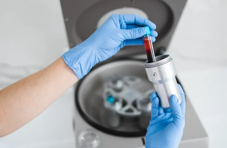 PRP Therapy in Rome, GA | Platelet-Rich Plasma Treatment